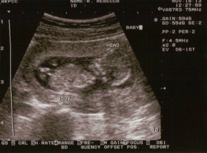 Whenever I look at tho photo of our baby at 12 weeks, it still fills me with a holy fear or reverence of God.  Wow!